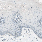 Immunohistochemical staining of human uterine cervix shows no positivity in squamous epithelial cells as expected.