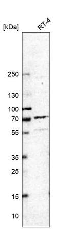 Western blot analysis in human cell line RT-4.