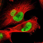 Immunofluorescent staining of human cell line U-251 MG shows localization to nucleoplasm.