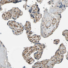 Anti-EFNB2 Antibody