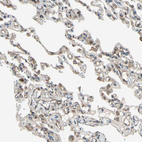 Anti-EFNB2 Antibody