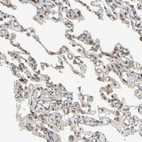 Immunohistochemical staining of human lung shows weak to moderate membranous positivity in pneumocytes.