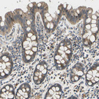 Anti-EFNB2 Antibody