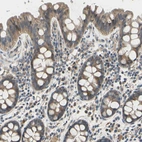 Immunohistochemical staining of human colon shows weak to moderate membranous positivity in glandular cells.