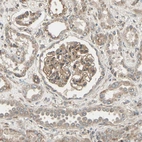 Immunohistochemical staining of human kidney shows moderate membranous positivity in cells in glomeruli.