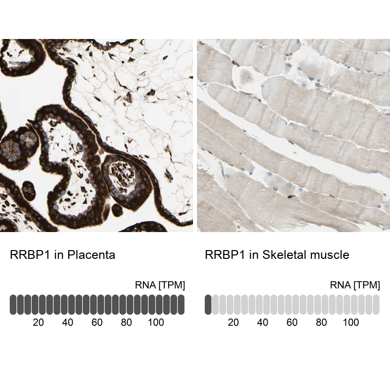 Anti-RRBP1 Antibody