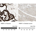 Anti-RRBP1 Antibody