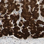 Immunohistochemical staining of human stomach shows strong cytoplasmic positivity in glandular cells.