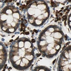 Immunohistochemical staining of human colon using Anti-RRBP1 antibody HPA009026.