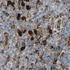 Immunohistochemical staining of human lymph node using Anti-RRBP1 antibody HPA009026.