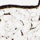 Immunohistochemical staining of human placenta using Anti-RRBP1 antibody HPA009026.