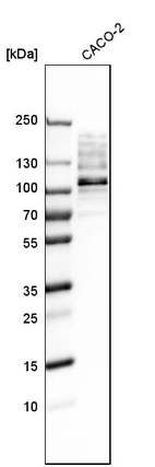 Western blot analysis in human cell line CACO-2.