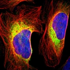 Immunofluorescent staining of human cell line U-2 OS shows localization to endoplasmic reticulum.