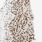 Anti-ZNF134 Antibody