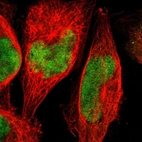 Immunofluorescent staining of human cell line A-431 shows localization to nucleoplasm.