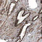 Immunohistochemical staining of human Prostate shows strong nuclear and cytoplasmic positivity in glandular cells.