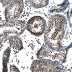 Anti-SOX7 Antibody