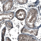 Immunohistochemical staining of human testis shows moderate nuclear and cytoplasmic positivity in cells in seminiferous ducts.