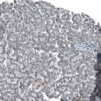Immunohistochemical staining of human Liver shows very weak nuclear positivity in hepatocytes.