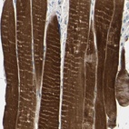 Anti-TPM3 Antibody