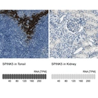 Anti-SPINK5 Antibody