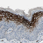 Immunohistochemical staining of human skin shows strong granular cytoplasmic positivity in squamous epithelial cells.