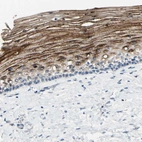 Immunohistochemical staining of human uterine cervix shows moderate granular cytoplasmic positivity in squamous epithelial cells.