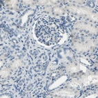 Immunohistochemical staining of human kidney shows low expression as expected.