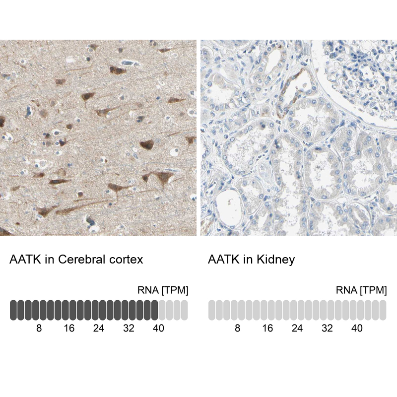 Anti-AATK Antibody