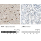 Anti-AATK Antibody