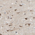 Immunohistochemical staining of human cerebral cortex shows high expression.