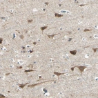 Immunohistochemical staining of human cerebral cortex shows high expression.
