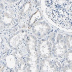 Immunohistochemical staining of human kidney shows low expression as expected.