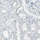 Immunohistochemical staining of human kidney shows low expression as expected.
