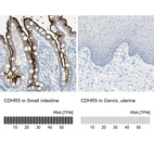 Anti-CDHR5 Antibody