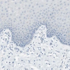 Immunohistochemical staining of human cervix, uterine shows low expression as expected.