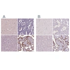 Immunohistochemical staining of human cerebral cortex, endometrium, liver and placenta using Anti-SIGLEC6 antibody HPA009084 (A) shows similar protein distribution across tissues to independent antibody HPA018198 (B).