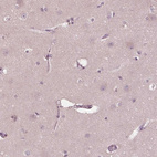 Immunohistochemical staining of human cerebral cortex shows no positivity in neurons as expected.