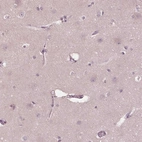 Immunohistochemical staining of human cerebral cortex shows no positivity in neurons as expected.