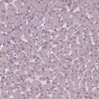 Anti-SIGLEC6 Antibody