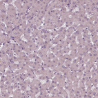 Immunohistochemical staining of human liver shows no positivity in hepatocytes as expected.