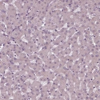 Immunohistochemical staining of human liver shows no positivity in hepatocytes as expected.