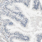 Immunohistochemical staining of human prostate shows no positivity in glandular cells.