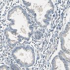 Immunohistochemical staining of human endometrium shows no positivity in glandular cells.