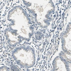 Immunohistochemical staining of human endometrium shows no positivity in glandular cells.