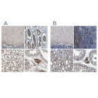 Anti-CLCC1 Antibody