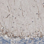 Immunohistochemical staining of human cerebellum shows weak positivity in neuronal processes.