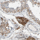 Immunohistochemical staining of human testis shows moderate cytoplasmic positivity in Leydig cells.