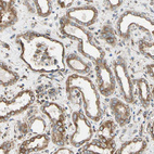 Immunohistochemical staining of human kidney shows moderate cytoplasmic positivity in cells in tubules.