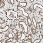 Immunohistochemical staining of human kidney shows moderate cytoplasmic positivity in cells in tubules.